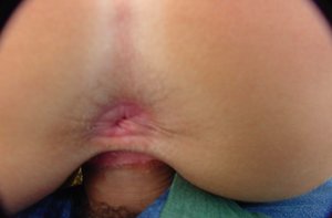 Kinky Florida Amateurs are excited to present you with a gallery showcasing luscious teen in sex scene with fuck in the ass